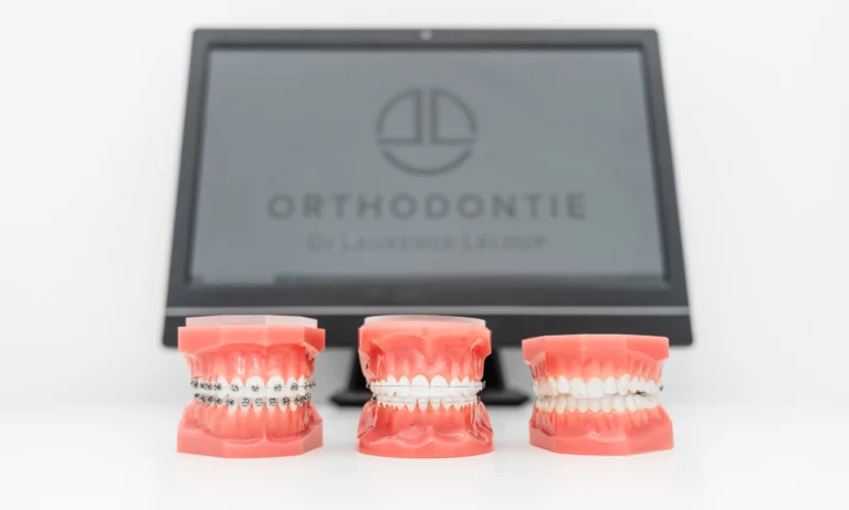 Prothèses au Cabinet Orthodontie Paris Boulogne